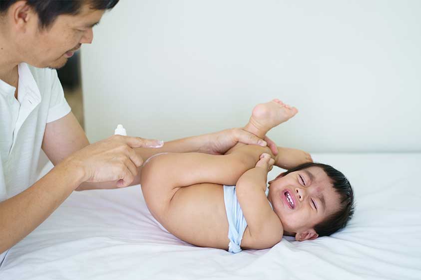 comment-soigner-erytheme-fessier-bebe